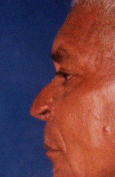 Antes y después · comparativo — después
