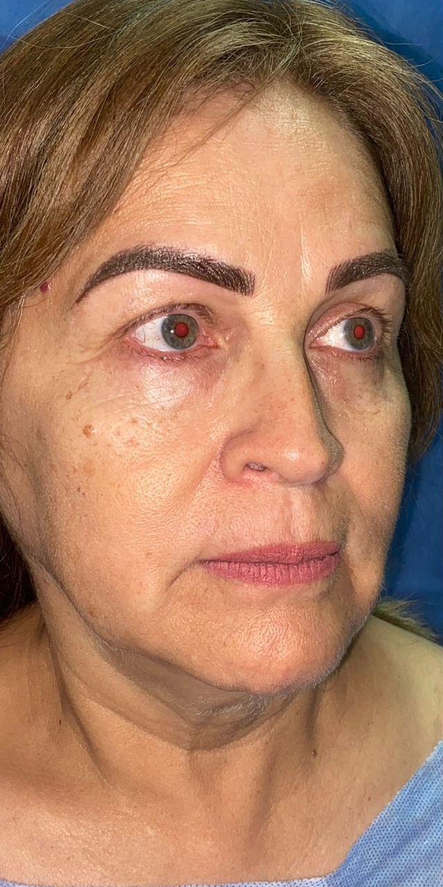 Antes y después · comparativo — antes