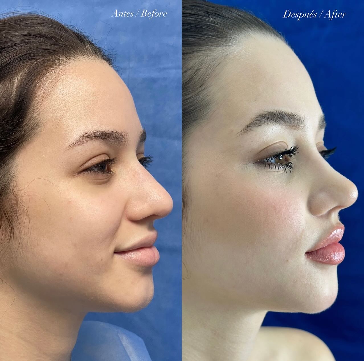 Antes y después · comparativo