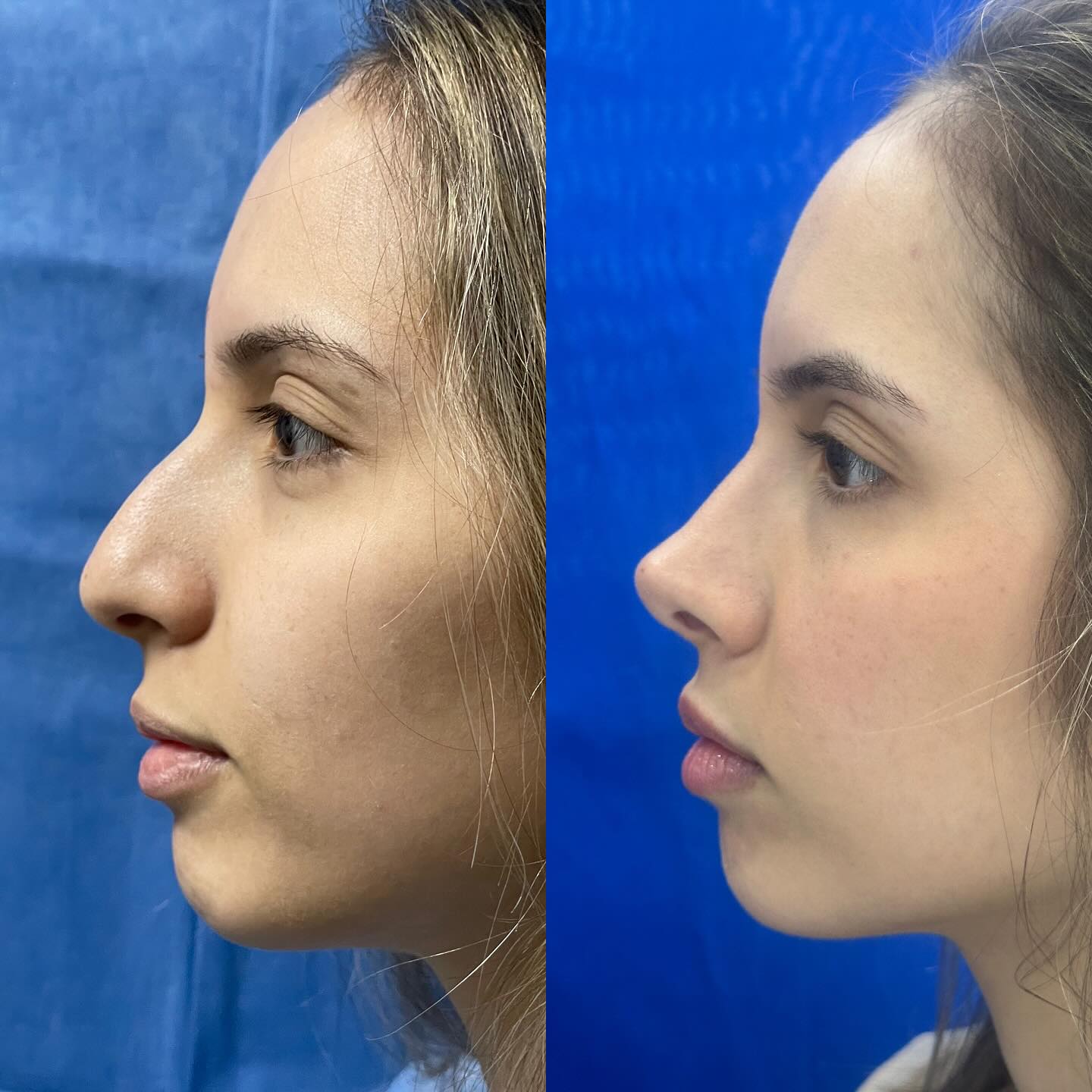 Antes y después · comparativo