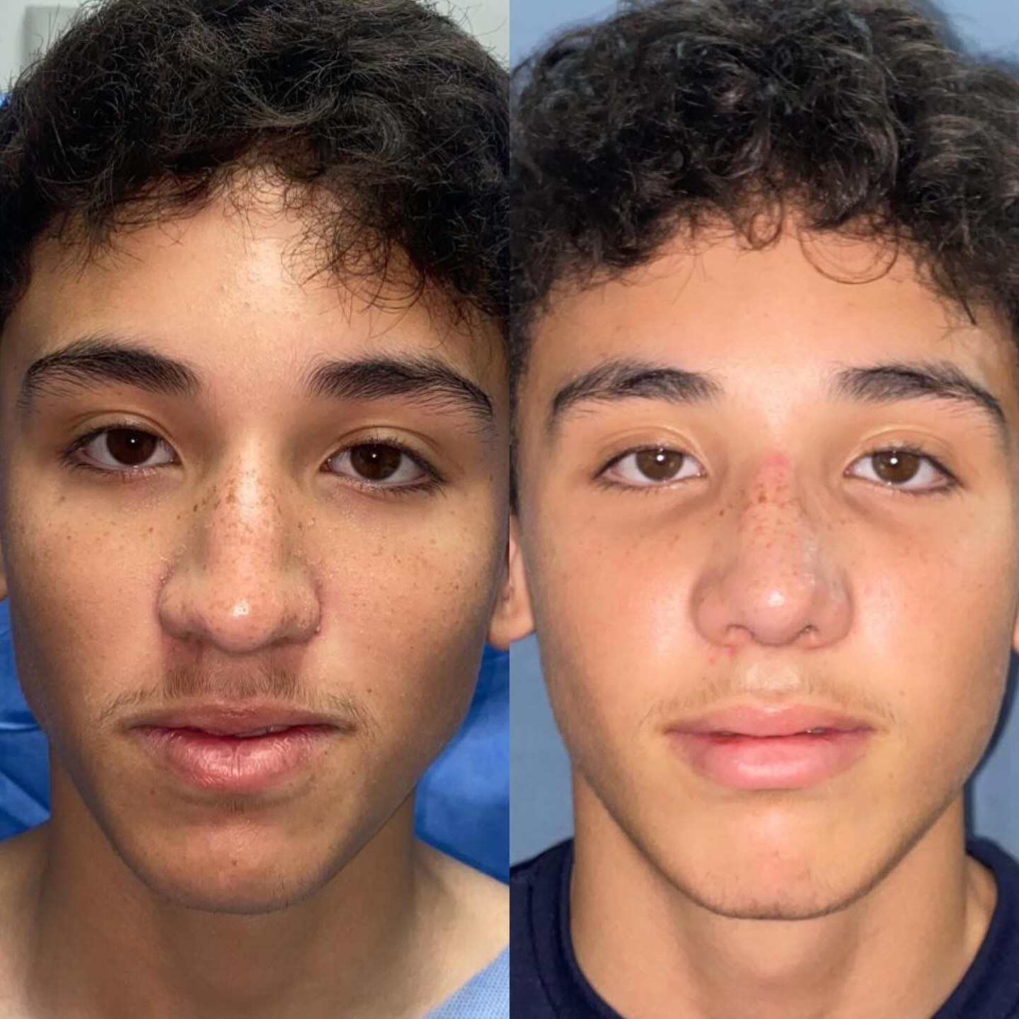 Antes y después · comparativo