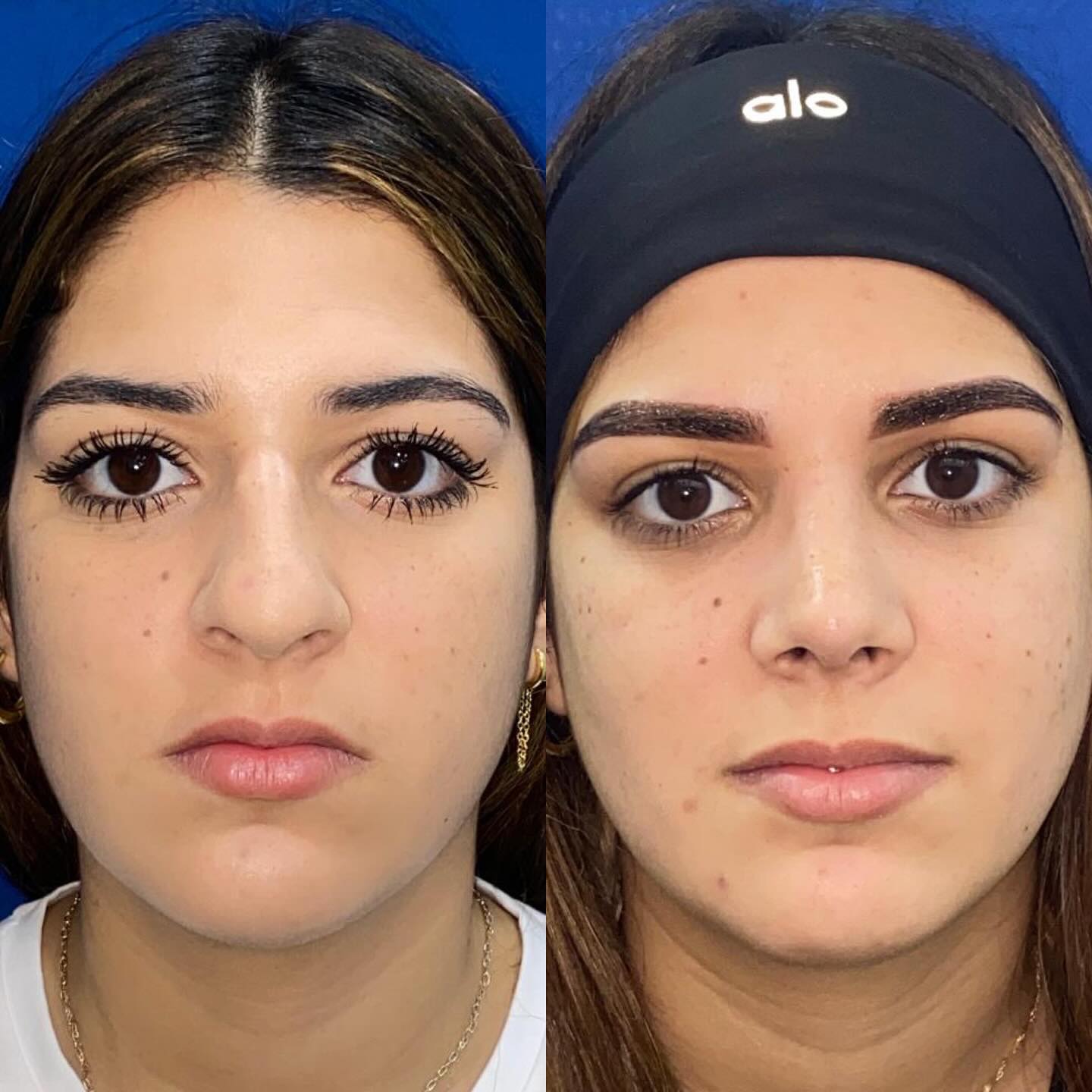 Antes y después · comparativo