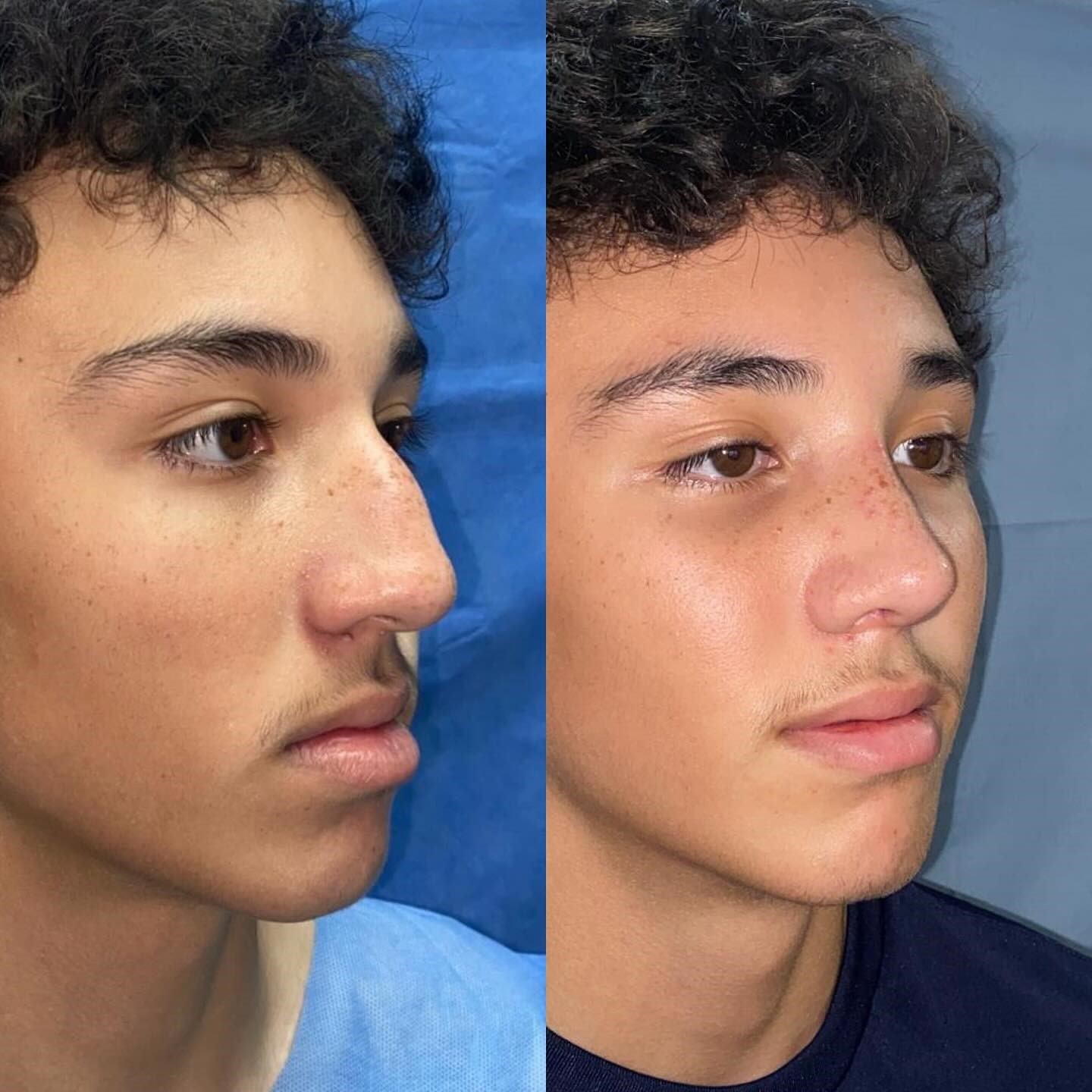 Antes y después · comparativo