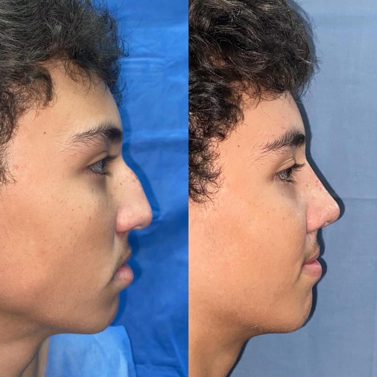 Antes y después · comparativo