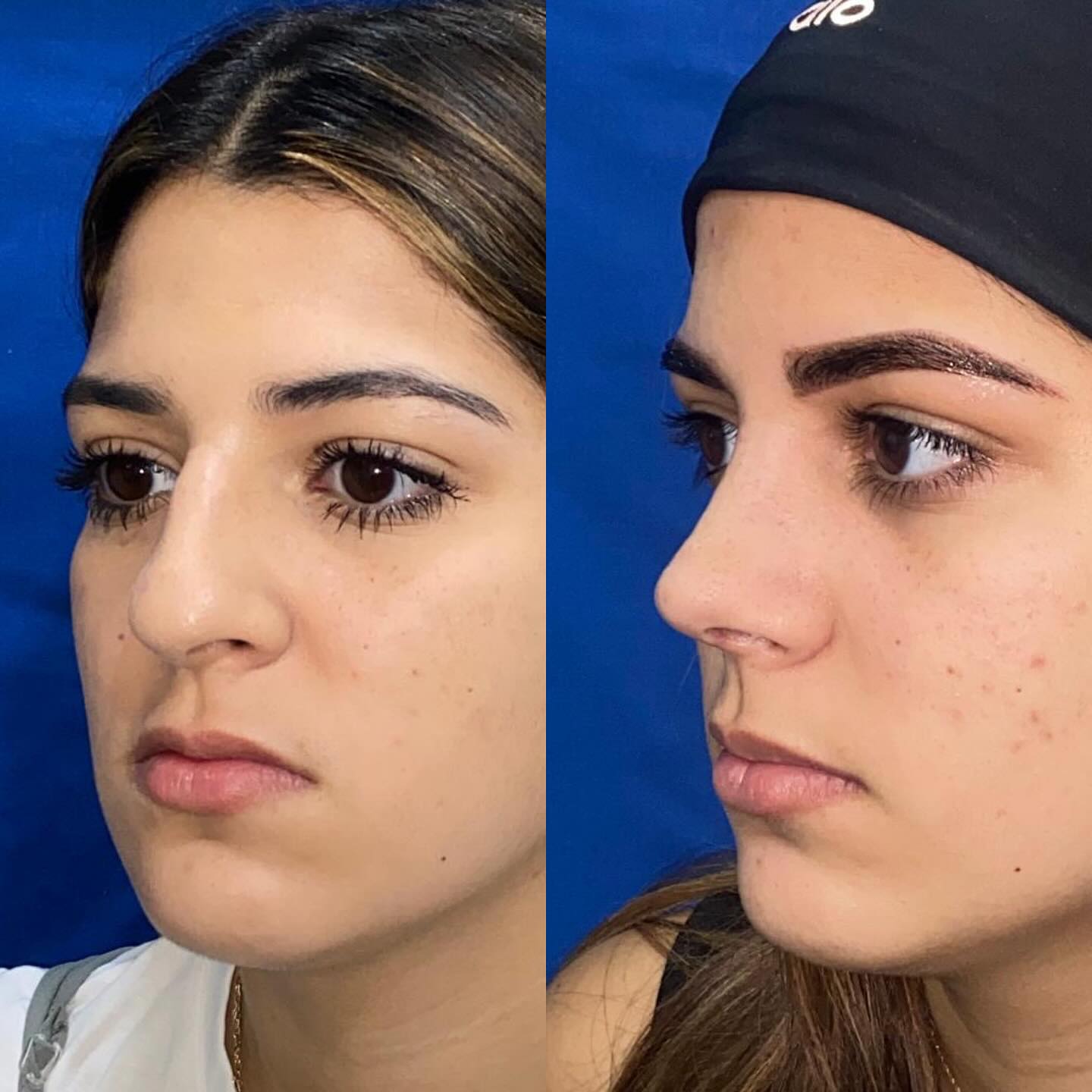 Antes y después · comparativo