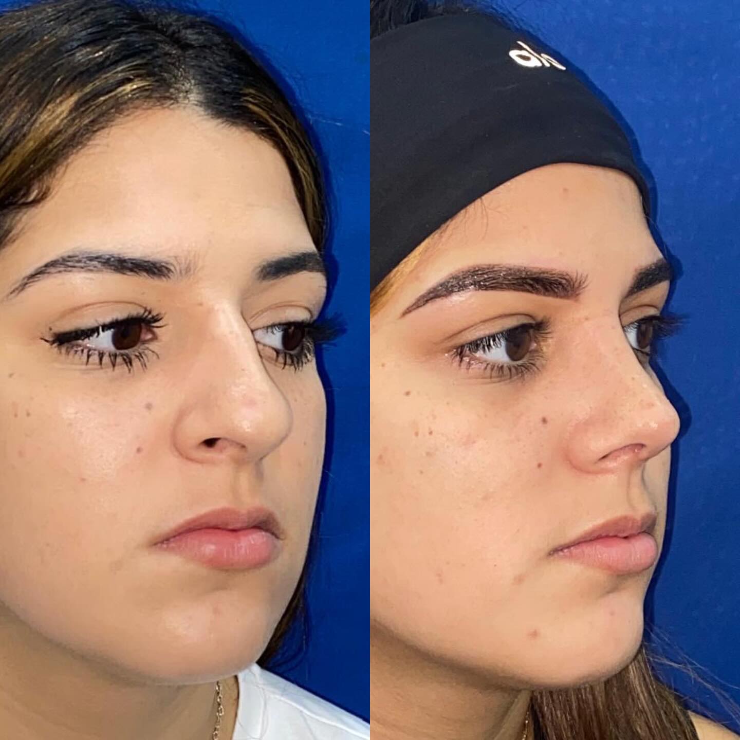 Antes y después · comparativo