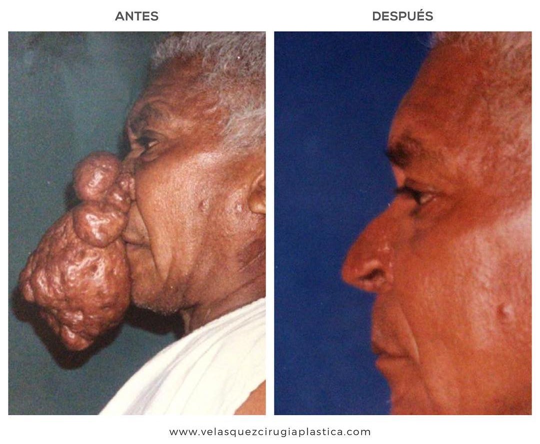 Caso ilustrativo
