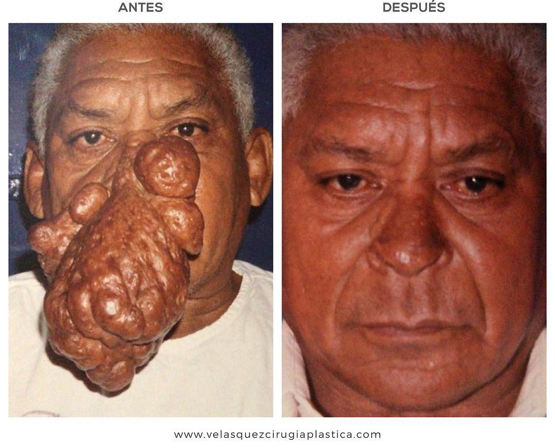 Caso ilustrativo